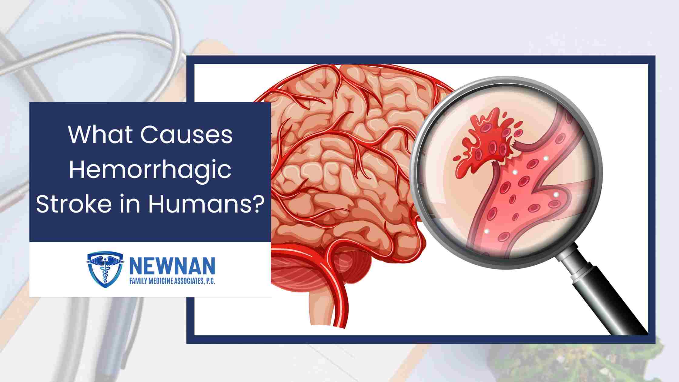What Causes Hemorrhagic Stroke in Humans?
