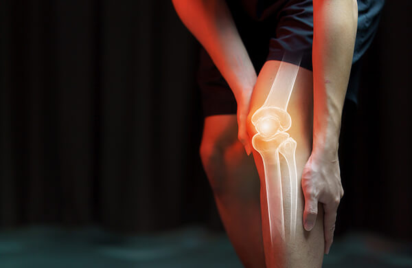 What is Arthritis